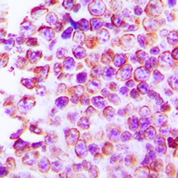 Claudin 4 Rabbit Polyclonal Antibody