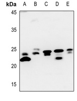 Claudin 7 Rabbit Polyclonal Antibody