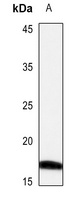 CRABP2 Rabbit Polyclonal Antibody