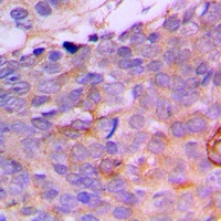 CRABP2 Rabbit Polyclonal Antibody
