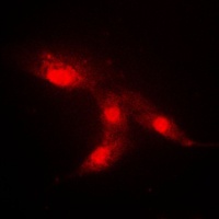 CRABP2 Rabbit Polyclonal Antibody