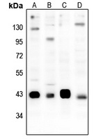CREB (Phospho-S133) Rabbit Polyclonal Antibody
