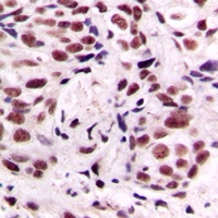 CREB (Phospho-S133) Rabbit Polyclonal Antibody
