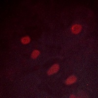 ATF2 (Phospho-S498) Rabbit Polyclonal Antibody