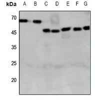 CRHR2 Rabbit Polyclonal Antibody
