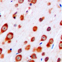 CRHR2 Rabbit Polyclonal Antibody