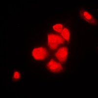XPO2 Rabbit Polyclonal Antibody