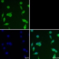 CK2 beta (Phospho-S209) Rabbit Polyclonal Antibody