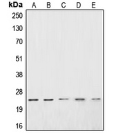 CSRP1 Rabbit Polyclonal Antibody