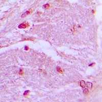 CSRP1 Rabbit Polyclonal Antibody