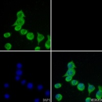 CSRP1 Rabbit Polyclonal Antibody