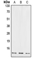 Cystatin B Rabbit Polyclonal Antibody