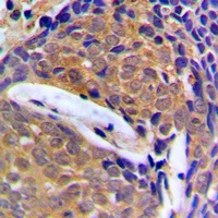 Cystatin B Rabbit Polyclonal Antibody