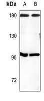 CUX1 Rabbit Polyclonal Antibody