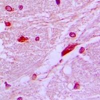 CUX1 Rabbit Polyclonal Antibody