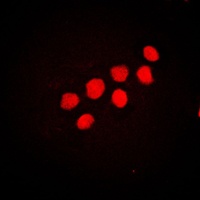 CUX1 Rabbit Polyclonal Antibody