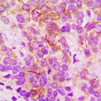 Cytochrome P450 2B6 Rabbit Polyclonal Antibody