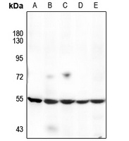 Cytochrome P450 17A1 Rabbit Polyclonal Antibody