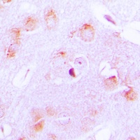 Cytochrome P450 17A1 Rabbit Polyclonal Antibody
