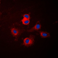 Cytochrome P450 17A1 Rabbit Polyclonal Antibody