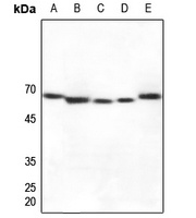 Cytochrome P450 27A1 Rabbit Polyclonal Antibody