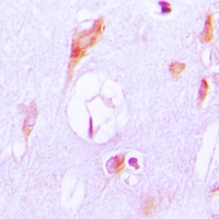 Cytochrome P450 27A1 Rabbit Polyclonal Antibody
