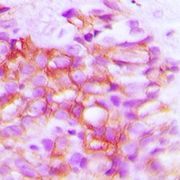 TRP2 Rabbit Polyclonal Antibody