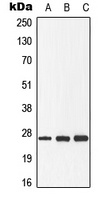 GADD153 (Phospho-S30) Rabbit Polyclonal Antibody