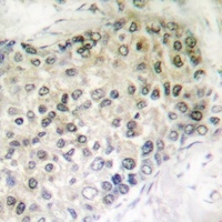 GADD153 (Phospho-S30) Rabbit Polyclonal Antibody