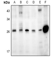 GADD153 Rabbit Polyclonal Antibody