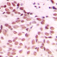 GADD153 Rabbit Polyclonal Antibody