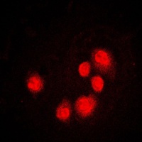 GADD153 Rabbit Polyclonal Antibody