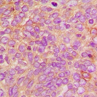 DFF45 Rabbit Polyclonal Antibody