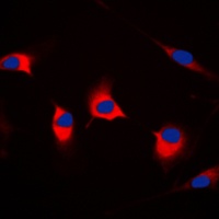 DFF45 Rabbit Polyclonal Antibody