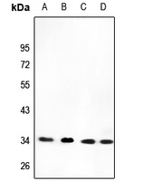 CYB5R3 Rabbit Polyclonal Antibody