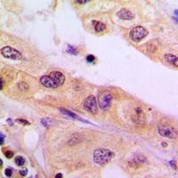 CYB5R3 Rabbit Polyclonal Antibody