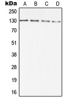 DIAPH2 Rabbit Polyclonal Antibody