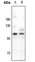 PSD93 Rabbit Polyclonal Antibody