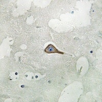 PSD93 Rabbit Polyclonal Antibody