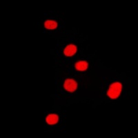 DLX5 Rabbit Polyclonal Antibody