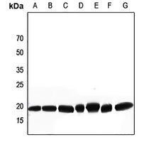 DSCR1 Rabbit Polyclonal Antibody