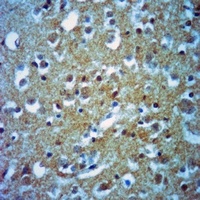 DSCR1 Rabbit Polyclonal Antibody