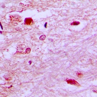 E2F6 Rabbit Polyclonal Antibody