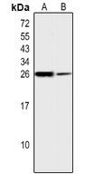EEF1B2 Rabbit Polyclonal Antibody