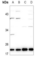 Ephrin A1 Rabbit Polyclonal Antibody