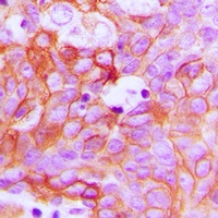 Ephrin A1 Rabbit Polyclonal Antibody