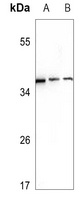 Ephrin A3 Rabbit Polyclonal Antibody