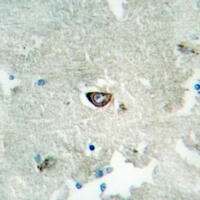 Ephrin A3 Rabbit Polyclonal Antibody