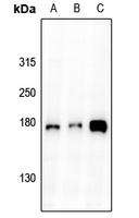 EGFR Rabbit Polyclonal Antibody