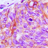 EGFR Rabbit Polyclonal Antibody